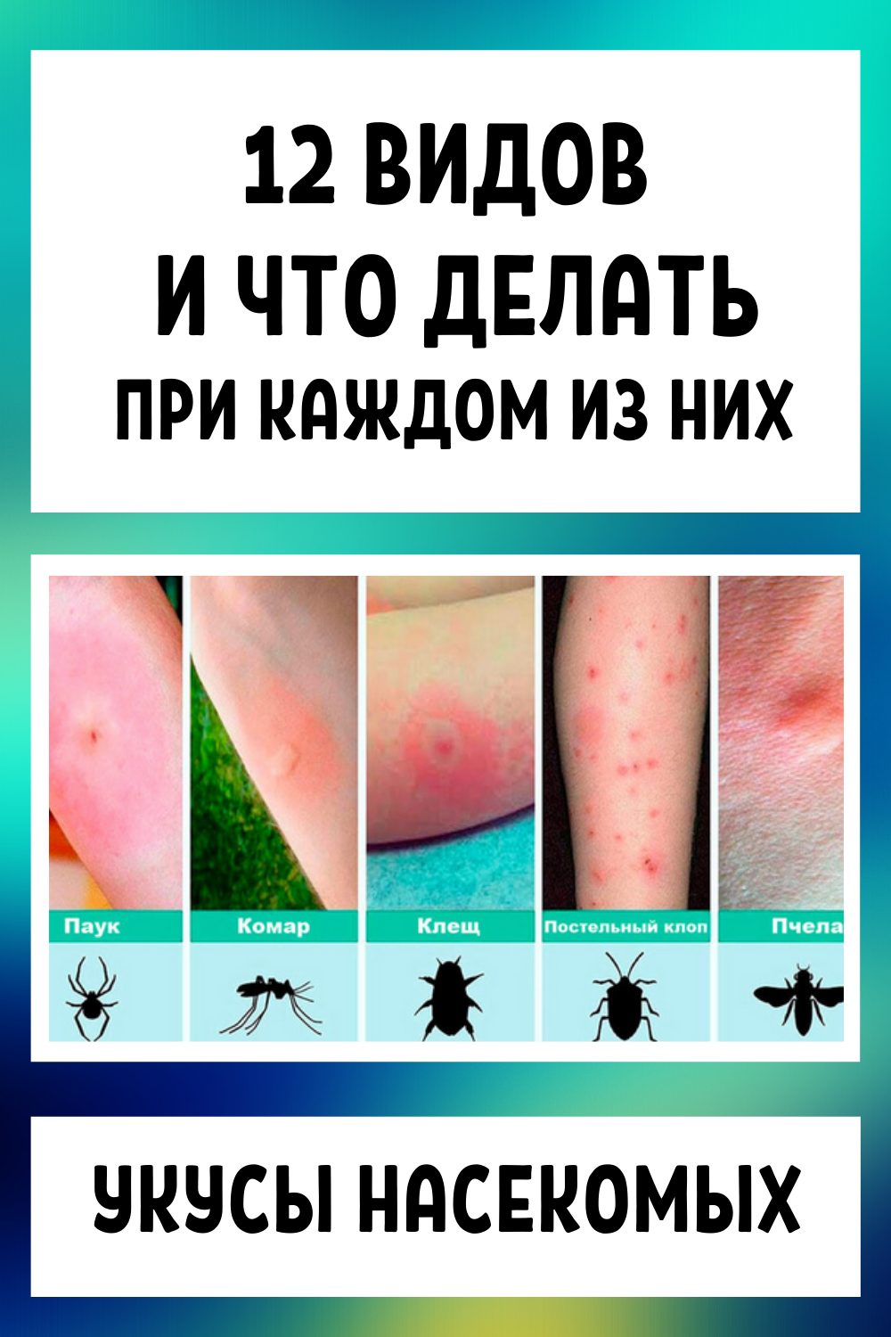 Укусы насекомых: 12 видов и что делать при каждом из них в домашних условиях + народные рецепты
