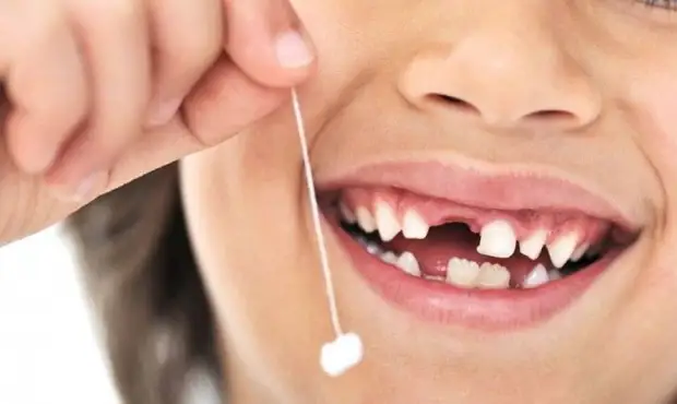 10 самых странных фактов о зубах ﻿
