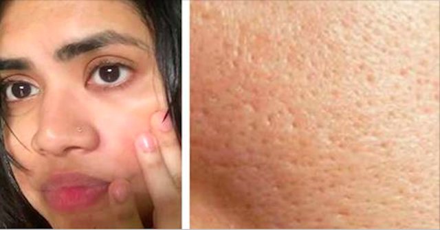 3 естественных метода, которые могут быстро сжимать поры Вашей кожи