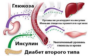 Древний рецепт поможет держать сахар в норме. Или как вылечить сахарный диабет